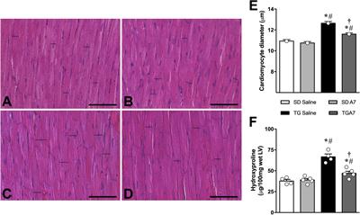 Angiotensin-(1-7) Central Mechanisms After ICV Infusion in Hypertensive Transgenic (mRen2)27 Rats